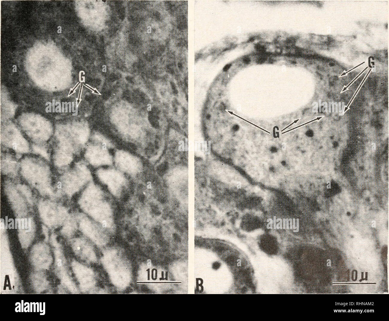 Aldehyde fuchsin hires stock photography and images Alamy