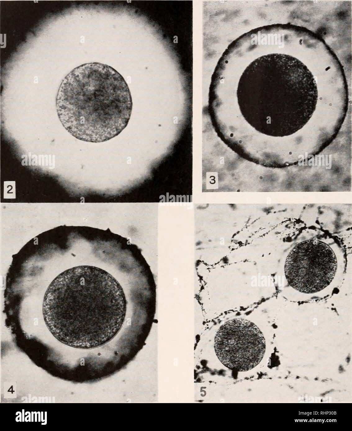 . The Biological bulletin. Biology; Zoology; Biology; Marine Biology. 192 JOHN A. FRANK. t PLATE I Microscopic appearance of the egg-agglutination reaction. All eggs photo- graphed in Chinese ink. FIG. 2. Normal .-irbacia egg in heated sea water surrounded by a wide zone of clear, colorless jelly. X 430. FIG. 3. A similar egg after five minutes exposure to a 5 per cent sperm extract. Note that a distinct agglutination membrane has appeared at the periphery of the jelly. X 430. FIG. 4. A similar egg after thirty minutes exposure to a 5 per cent sperm extract. The agglutination membrane has beco Stock Photo