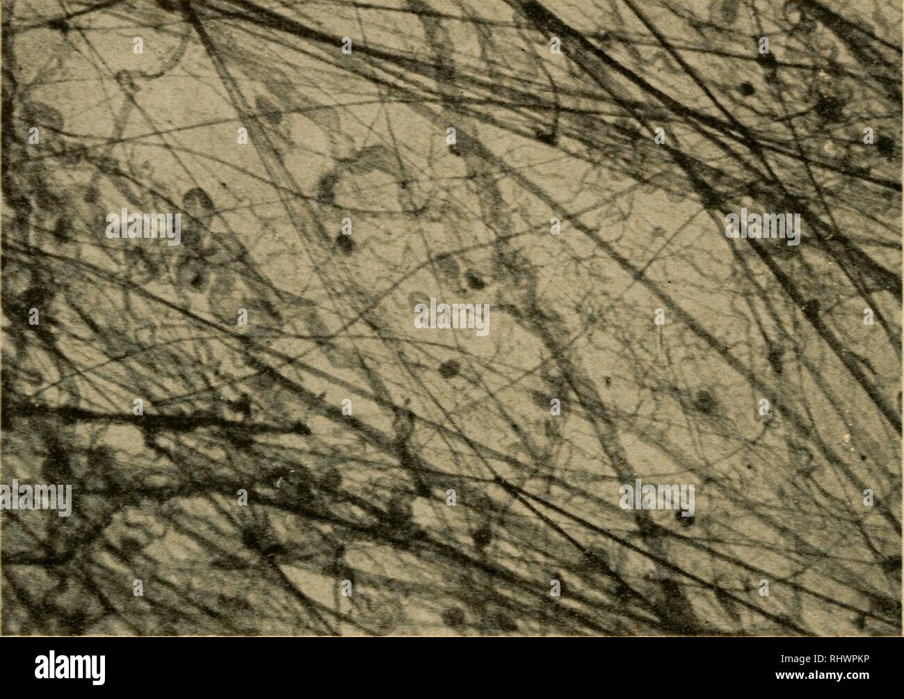 Reticular connective tissue hi-res stock photography and images - Alamy