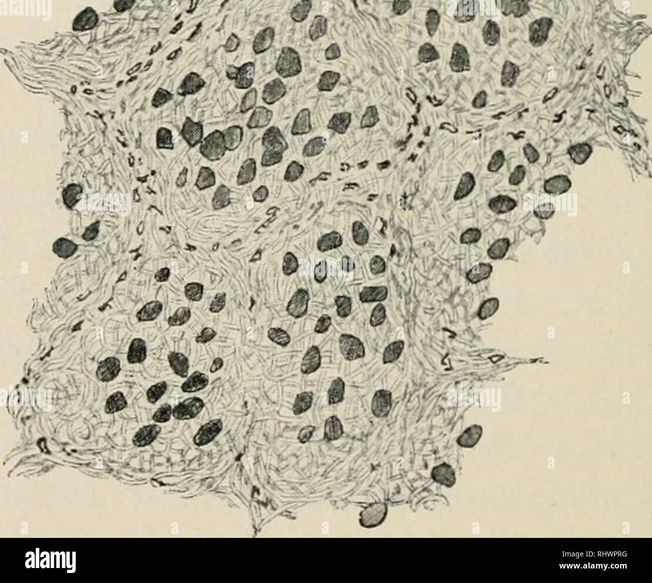 . Beitrge zur wissenschaftlichen Botanik. Plants. Fig. 3. Schematisch. 'i:cf.'^ t^Ã^r^- â¢-â &lt;r^'^-:&lt;ii. Fig. 4. FlÃ¤chenschnitt durch den Thallus von Rhicocarpon subconcentricum (Arnold No. 122). Verwachsung einzelner Thallusfelder. Die kleinen schwÃ¤rzlichen Partikelchen sind Reste der frÃ¼heren Berindung der Einzelfelder und lassen den Verlauf der Grenzlinien noch erkennen. Die Hyphen am Rande der frÃ¼heren Einzelfelder ziehen noch dem Rande entlang, sind aber mit denen der Nachbarfelder verflochten.. Please note that these images are extracted from scanned page images that may have b Stock Photo