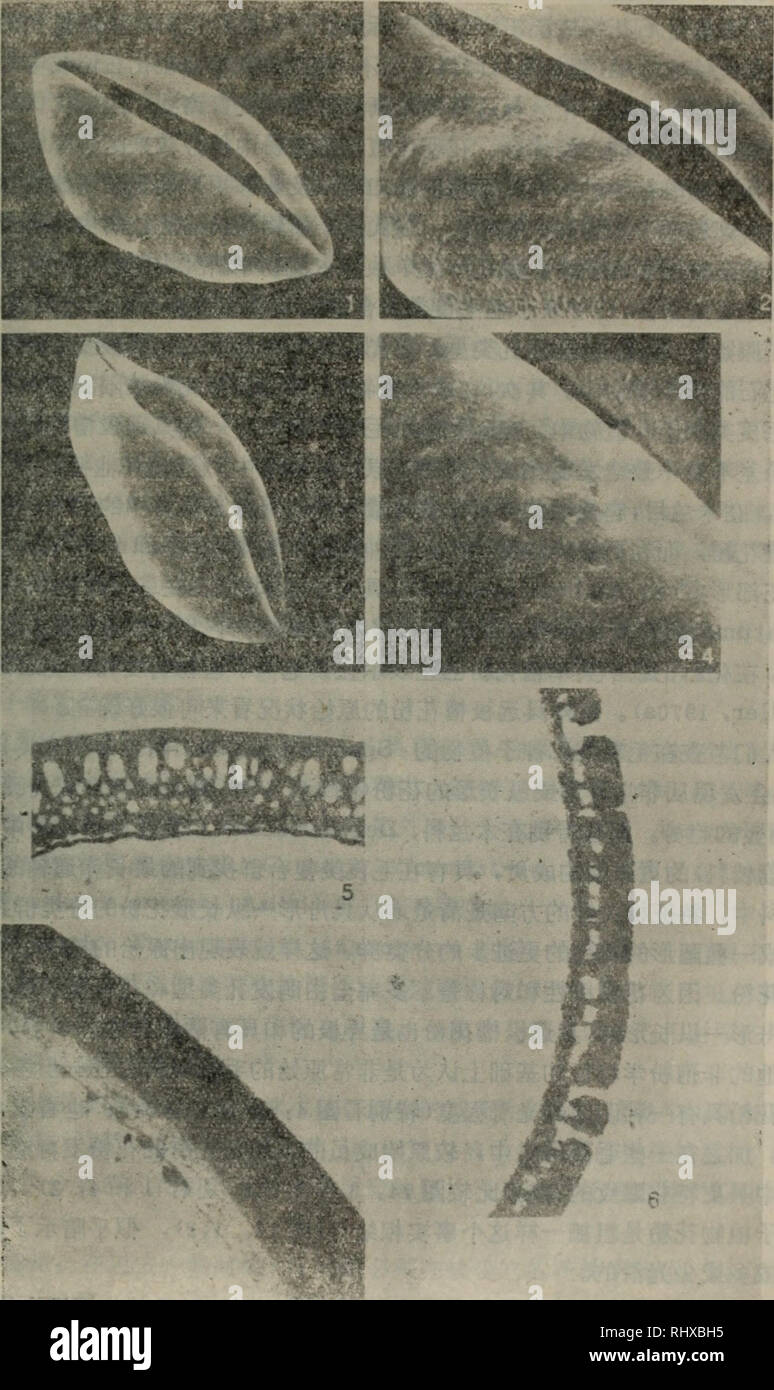 . bei zi zhi wu de qi yuan he zao qi yan hua è¢«å-æ¤ç©çèµ·æºåæ©ææ¼å. botany. ä¸äºåç±»ç¾¤æå ³ç³»çåå§ç¹å¾çåç±»ç¾¤ãåå§ç¹å¾çè¿ç§ä¿çç»å¸¸ç¨æ¥æ¨è®ºæ¯è¾æ©æç æ¼åèµ·æºï¼ä½ä¸å¯è½æ»æ¯è¿ç§æ åµã. åº14ä»ç°å-çè£¸å-æ¤ç©ååå§çè¢«å-æ¤ç©æ¨è®ºçç¥å è¢«å-æ¤ç©è±ç²ç¹å¾ã'ï¼1,2)èé (P-969)(l. Xçº¦2500: 2.Xçº¦5000)ã (3, 4) Anaxagorea costaricrnsis R. E. Fries (P-164) (3. Xçº¦1000: 4. Xçº¦lOOOO), (5â7)è±ç²å£è¶ èåççéå°çµå-æ¾å¾®é°ç §çï¼ (5)èéï¼P-969) CXçº¦7000)ã ï¼6) Calycanthus floridus L. (P-38) (Xçº¦5850)ã (7) Degeneria vitiensis 1. W. Bailey and A. C. Smith (P-12) (Xçº¦8152)ã â¢ 191 .. Please note that these images are e Stock Photo