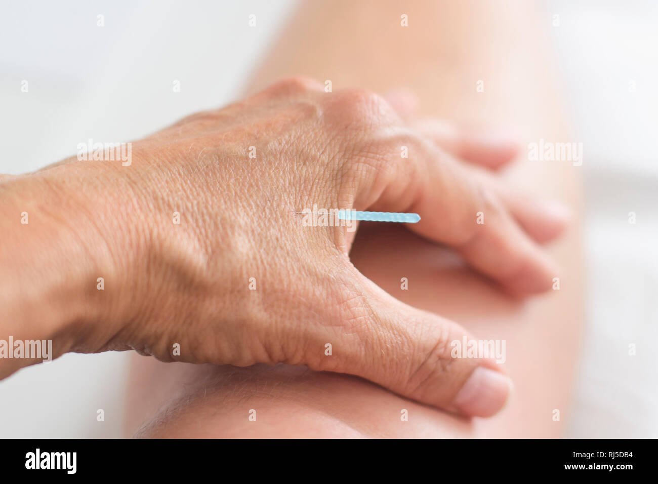 Akupunktur Nadel steckt in der Hand einer Frau Stock Photo