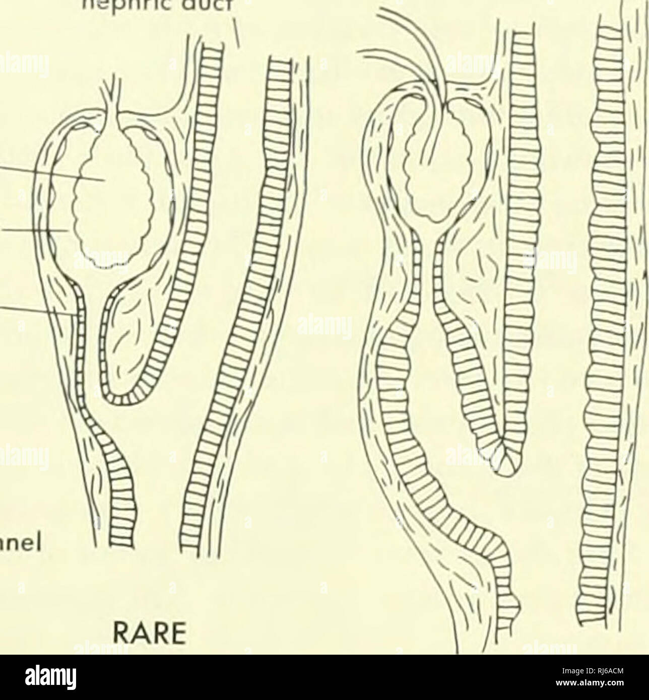 . Chordate morphology. Morphology (Animals); Chordata. left pronephros duct of Cuvier nephrtc duct kidney glomerulus Bowmon's capsule neck section     y^ 2=srE;32jj^  segmental artery posterior cardinal (subcordinol) channel segmental vein segmental nerve. USUAL B dorsal aorta Figure 10-30. Kidney of Myxine. A, anterior end of kidney as seen from below, and relationships to blood vessels; B, two types of tubules observed in the adult kidney. (A after Marinelli and Strenger, 1956; B after Conel, 1917) lost and the coelom extends to what was their medial walls. Segmental funnels form and the cav Stock Photo