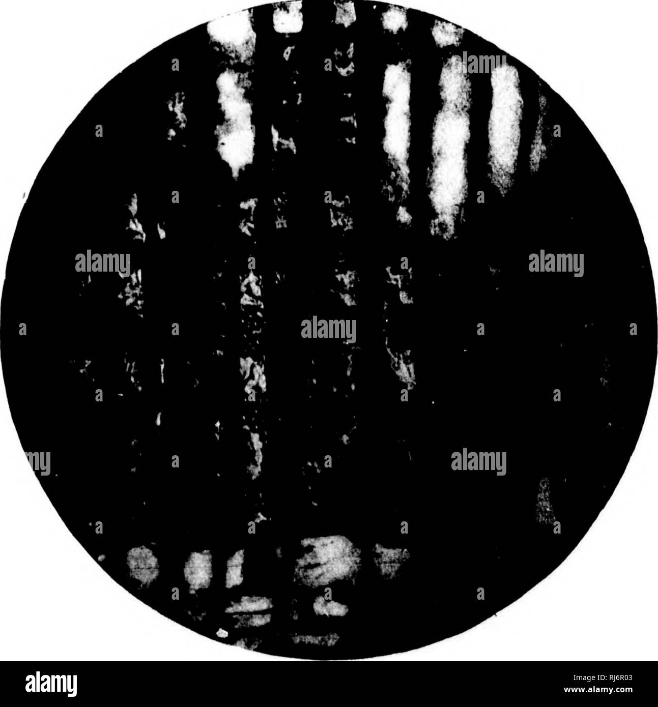 Isd Black And White Stock Photos Images Alamy