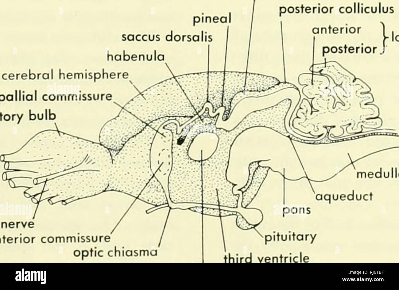 Dcx Sagittal T1 Weighted Image A Shows Enlarged Massa Intermedia Download Scientific Diagram