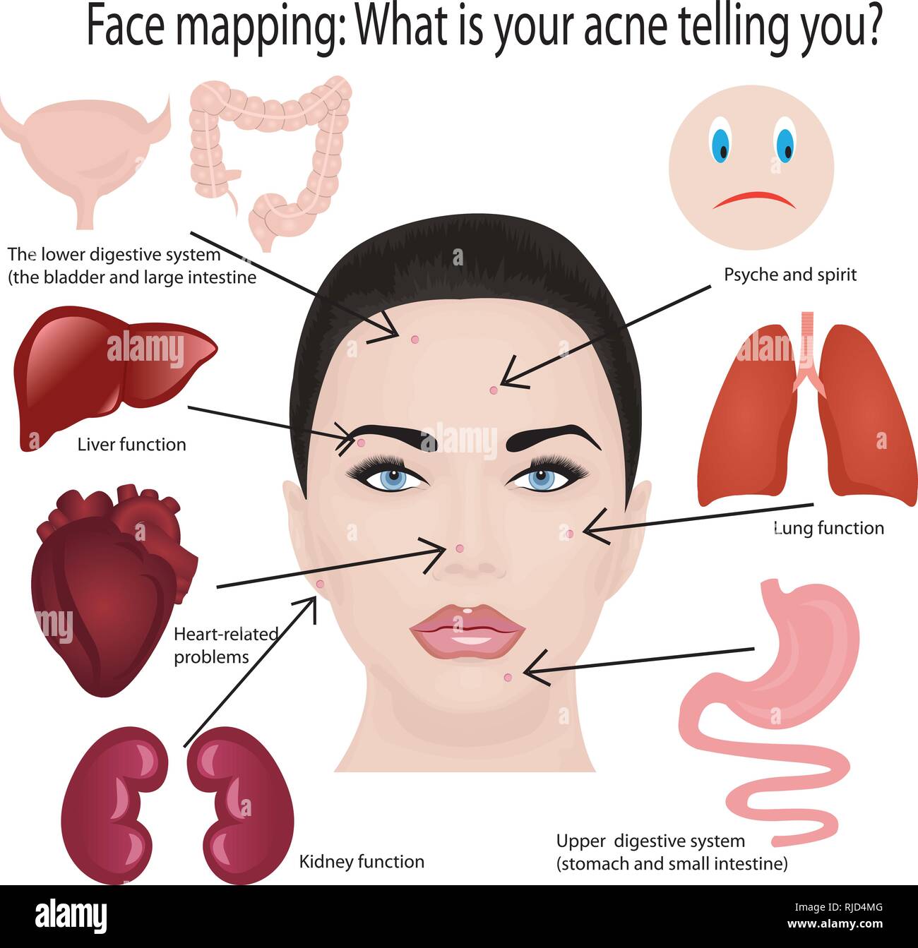 Face Mapping What Your Breakouts Are Telling You Abou - vrogue.co