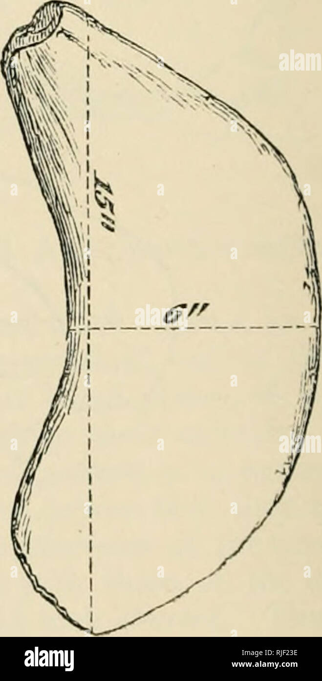 Page 2 Thyro Hyoid High Resolution Stock Photography And Images Alamy
