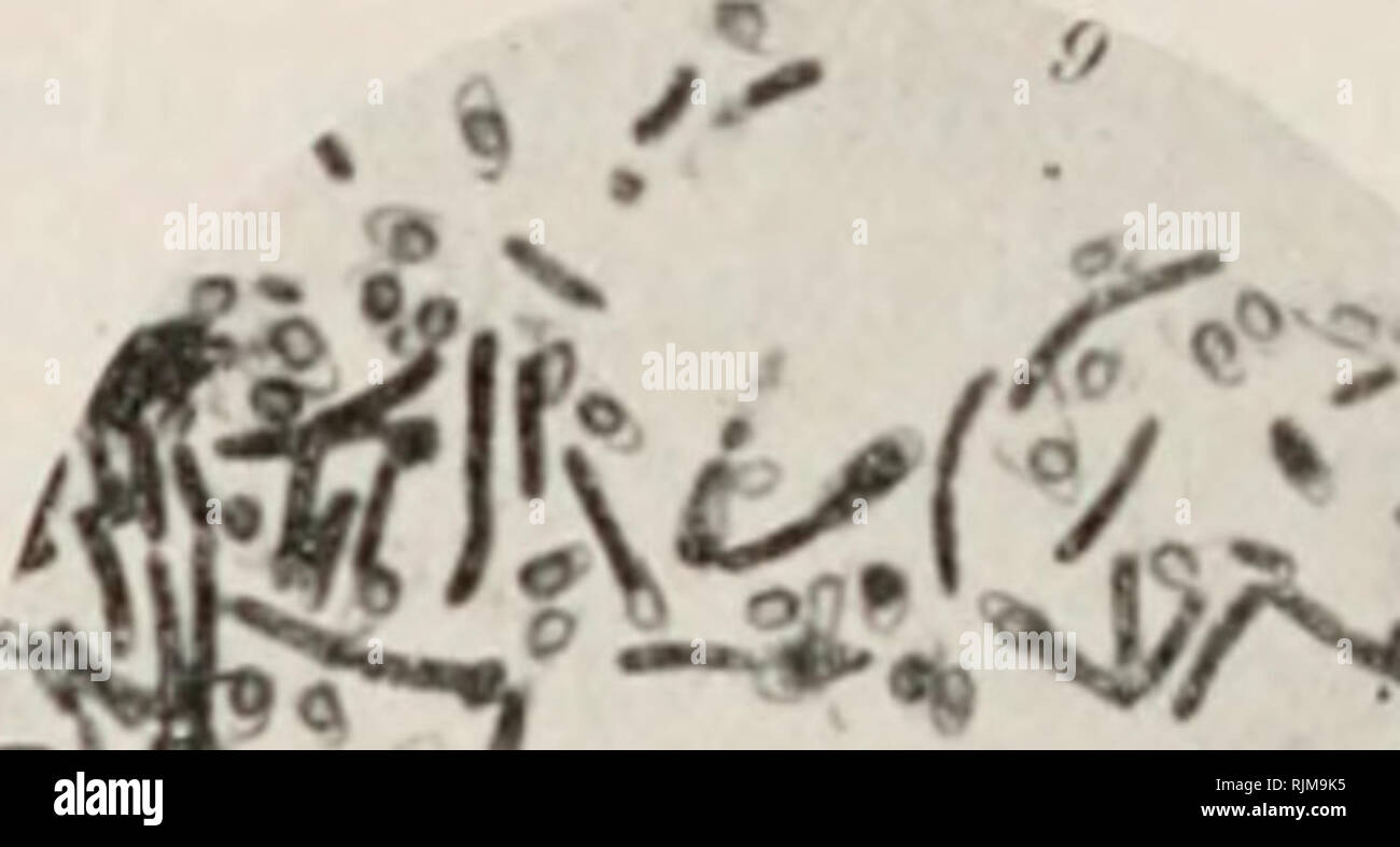 . Bau und leben der bakterien. Bacteriology. ÖlO XVII. Die stickstoffbindenden Bakterien. die etwa die Form kleiner Kefirkörner haben und, wie die mikro- skopische und kulturelle Analyse ergibt, aus mehreren Bakterienarten bestehen. In den klassischen Versuchen, die zum erstenmal in der ge- schilderten Weise durchgeführt wurden, konnten in diesen Körnchen drei sporenbildende Arten gefunden werden, unter diesen auch das logen- bakterium. Es gelang, alle drei rein zu züchten und zu erweisen, daß von ihnen nur das letztgenannte Stickstoff binden kann. Seine Rein- kultur gelang zuerst auf möglichs Stock Photo