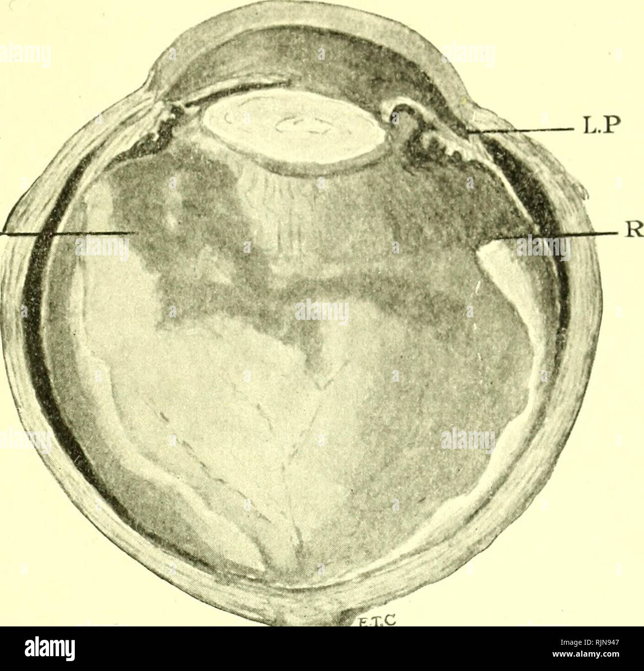 . Pathology and bacteriology [electronic resource]. Ophthalmology; Eye ...