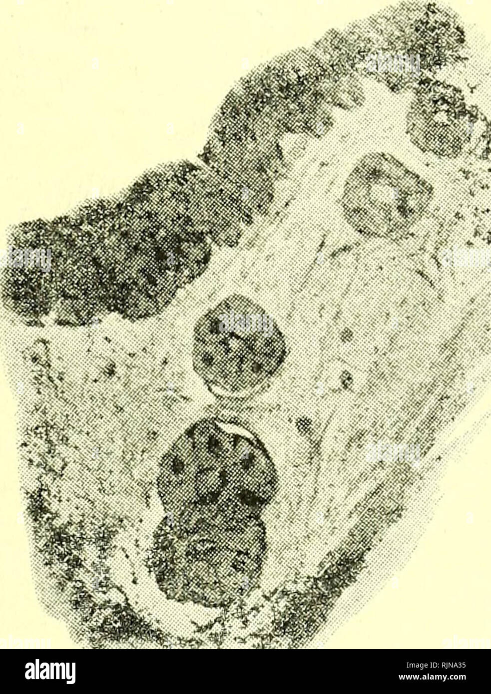Pectinate ligament hires stock photography and images Alamy