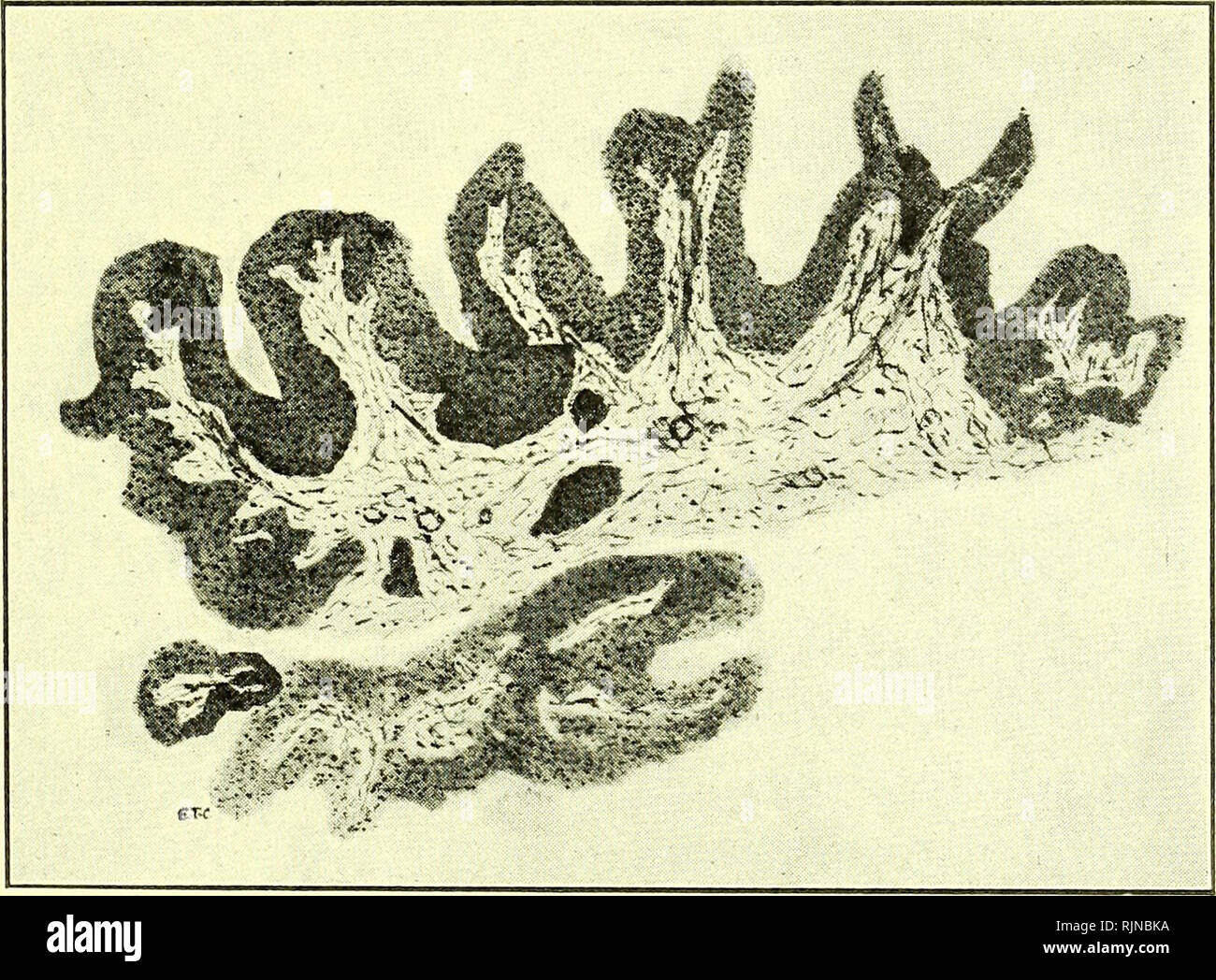 . Pathology and bacteriology [electronic resource]. Ophthalmology; Eye ...