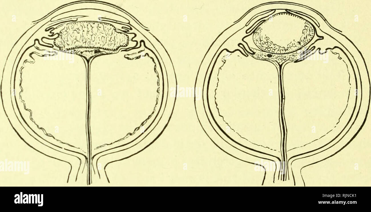 . Pathology and bacteriology [electronic resource]. Ophthalmology; Eye ...