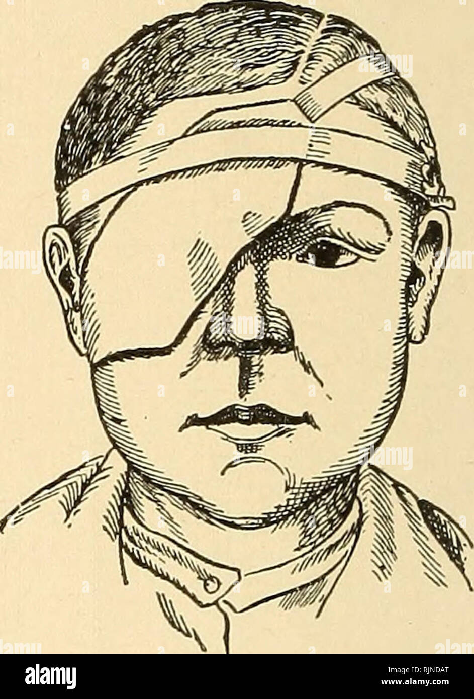 . Bacteriology and surgical technic for nurses. Nurses and nursing