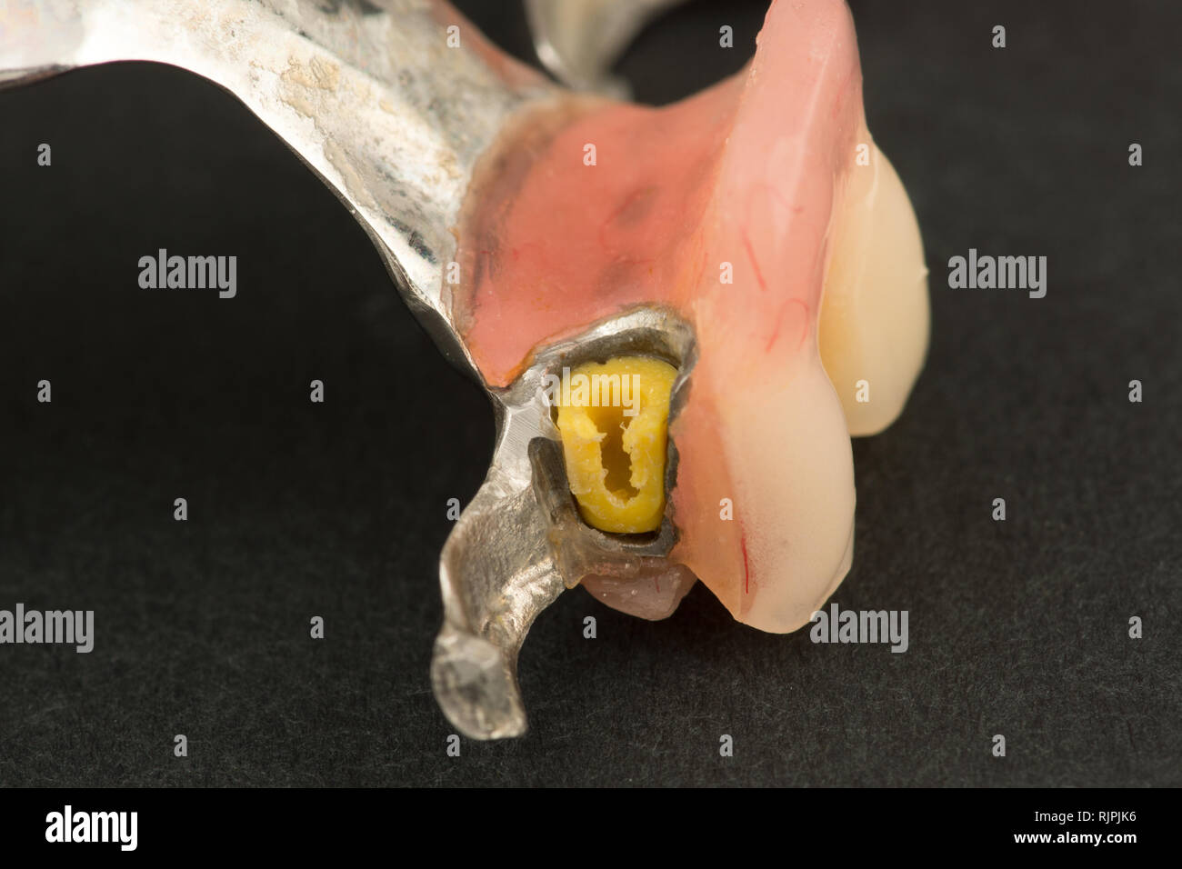 image of a modern arc  denture with attachment on a black background Stock Photo