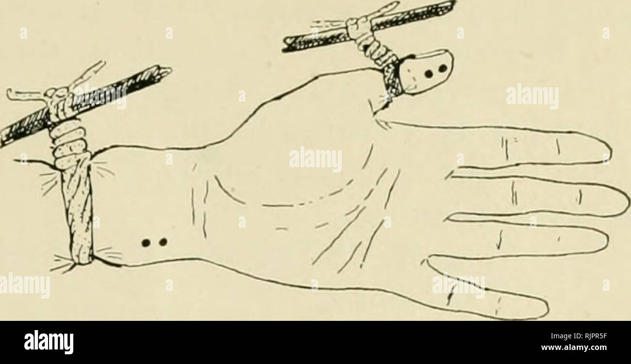 The Australian Museum Magazine Natural History The Australian Museum Magazine Ligatures Tied To Prevent Snake Poison Spreading Through The Blood To The Heart The Dots Represent Bite Marks Throughout The World