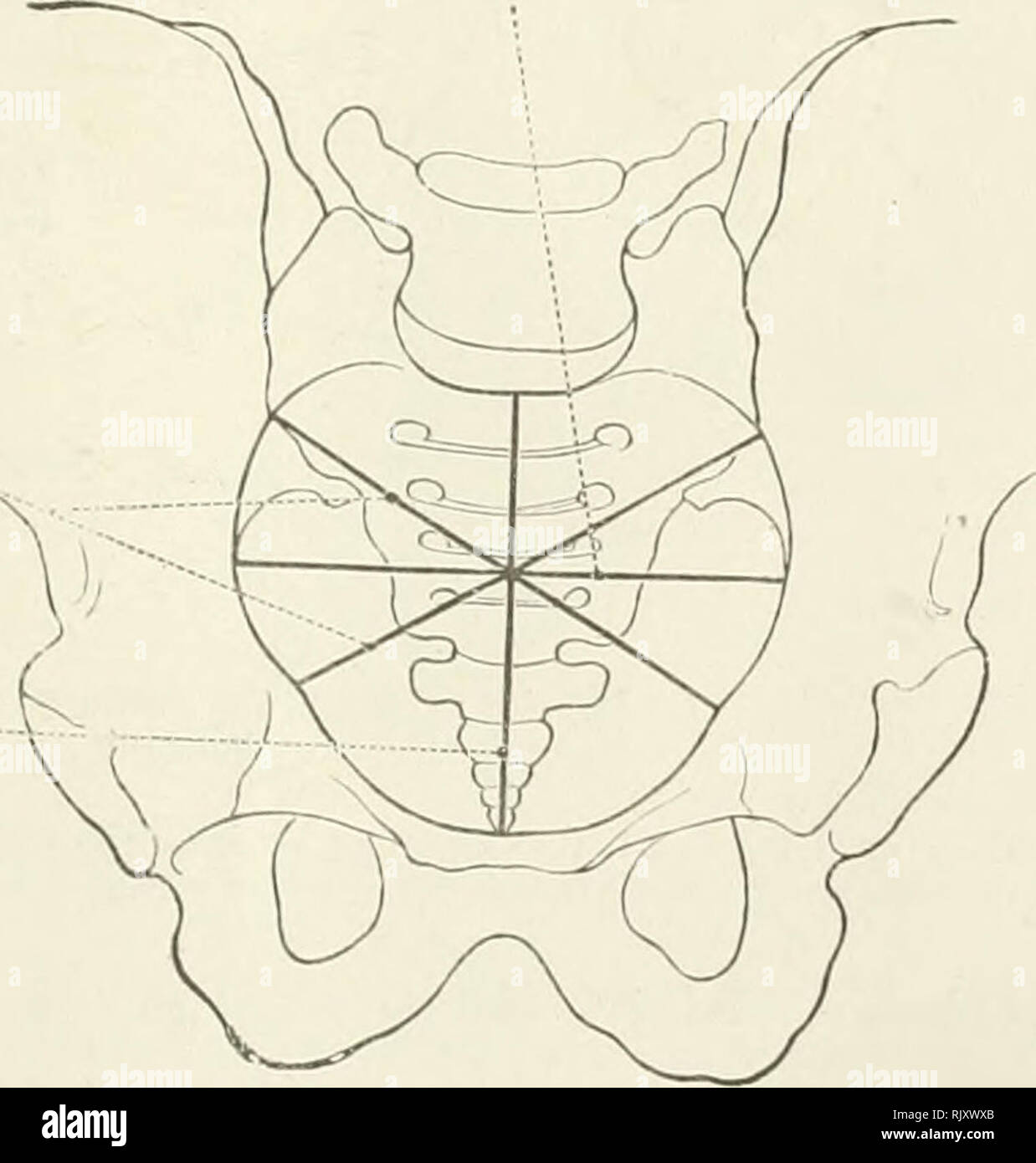 . An atlas of human anatomy for students and physicians. Anatomy. — Median-sagittal or antero-postenor diameter of the pelvic cavity Axis of the pelvic canal Axis pelvis Median-sagittal or antero-posterior diameter of the pelvic outlet Horizontal plane Fig. 309.—The Median-Sagittal or Anteroposterior Diameters of the True Pelvis. Transverse diameter Diameter transversa Oblique diameter Diameter obliqua'&quot;&quot;. Antero-posterior diameter, or (T true conjugate - J Conjugata (vera). Fig. 310.—The Diameters of the Pelvic Inlet (Apertura Pelvis Superior). The Principal Diameters of the True  Stock Photo
