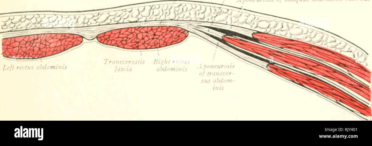 Transversalis Fascia Defects