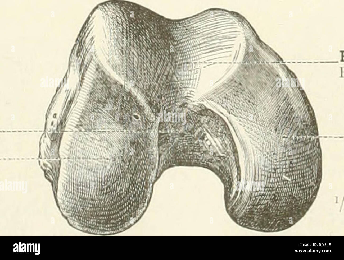 . An atlas of human anatomy for students and physicians. Anatomy. External condyle Condylus lateralis Fig. 325.—Distal Extremity of the Right Femur. Seen from the Outer Side. Intercondylar fossa Fossa intercondyloidea External condyle Condylus lateralis. Patellar surface Facies patellaris .Internal condyle Condylus medialis Fig. 326.—Distal Articular Extremity of the Right Femur. Seen from Below. Femur—The femur.. Please note that these images are extracted from scanned page images that may have been digitally enhanced for readability - coloration and appearance of these illustrations may not  Stock Photo