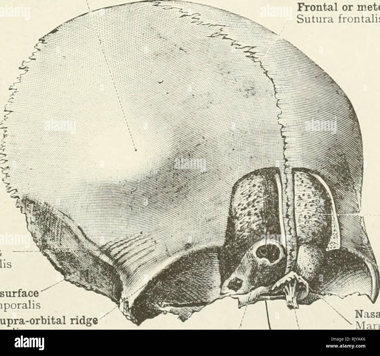 . An atlas of human anatomy for students and physicians. Anatomy. Frontal squama Squama frontalis - Orbital arch, or supra-orbital ridge Margo supra-orbitalis Orbital plate Pars orbitalis Nasal portion Pars nasalis Fig. 155.—The Two Halves of the Frontal Bone from a Hi'man Fcetus in the Eighth Month (Months of Four Weeks Each). Seen from Before. Body-length of foetus 15 inches. Frontal eminence Tuber frontale Temporal crest Linea temporalis Temporal surface' Facies temporalis Orbital arch, or supra-orbital ridge Margo supra-orbitalis. Frontal or metopic suture (var.) Sutura frontalis (var.) In Stock Photo