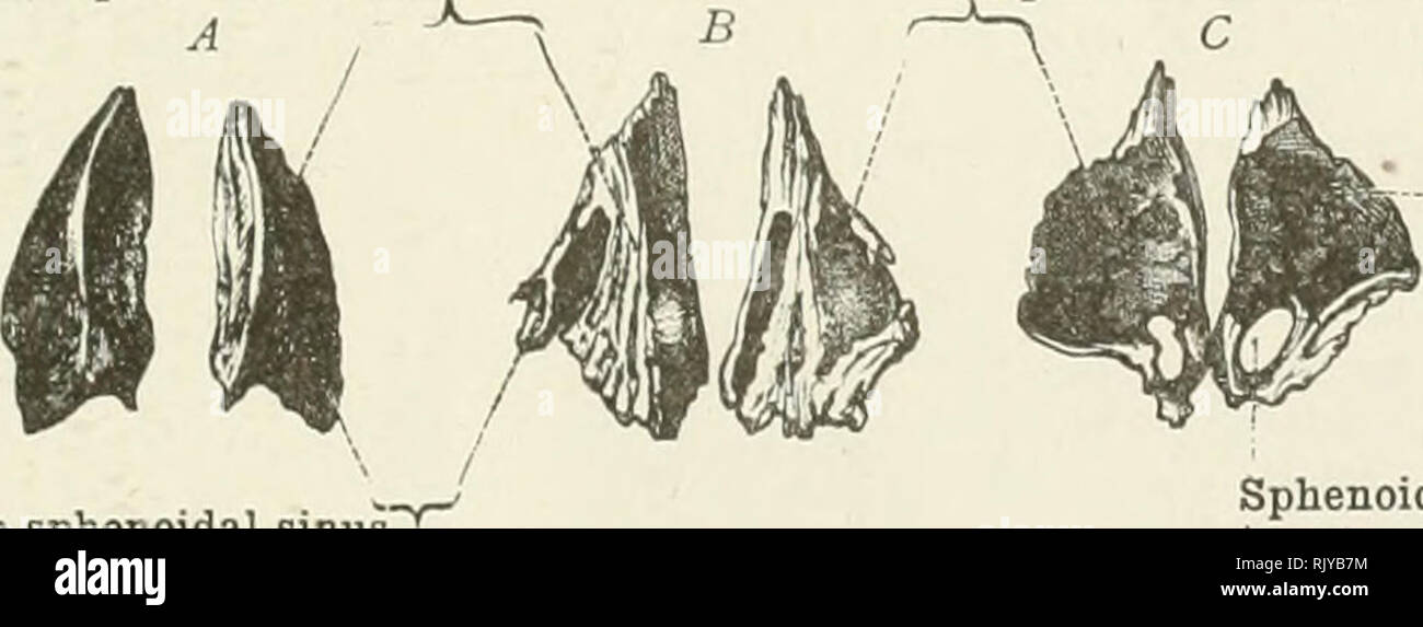 . An atlas of human anatomy for students and physicians. Anatomy. Foramen ovale Foramen ovale  Dorsum sellaeâDorsum sella? Body of the sphenoid bone (postsphenoid portion, or basisphenoid) Corpus ossis sphenoidalis (pars posterior) born at Full Term, seen from Above. Body of the sphenoid bone (presphenoid portion) Corpus ossis sphenoidalis (pars anterior) Vidian or pterygoid canal Canalis pterygoideus (Vidii) Foramen rotundum Foramen rotundum )â &gt; Orbital surface of the great wing *^â Facies orbital is ala? magna? Temporal surface of the great wing Facies temporalis ala? magna? Pterygoid  Stock Photo