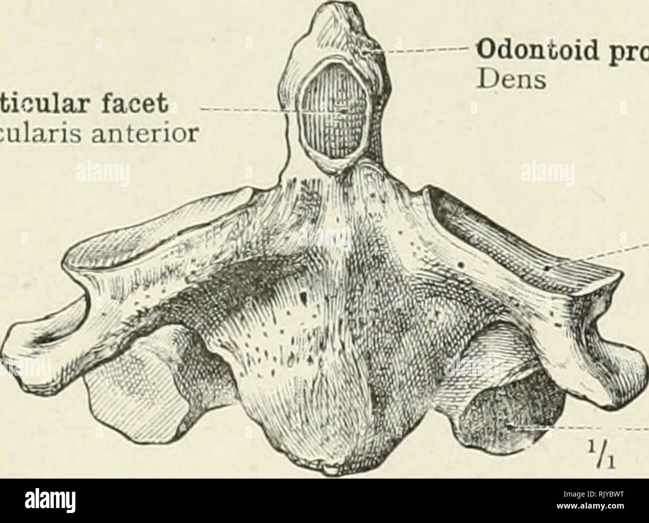 An Atlas Of Human Anatomy For Students And Physicians Anatomy Lateral Mass Massa Lateralis Anterior Arch Arcus Anterior Anterior Tubercle Tuberculum Anterius Fig 53 The Atlas Or First Cervical Vertebra Seen From