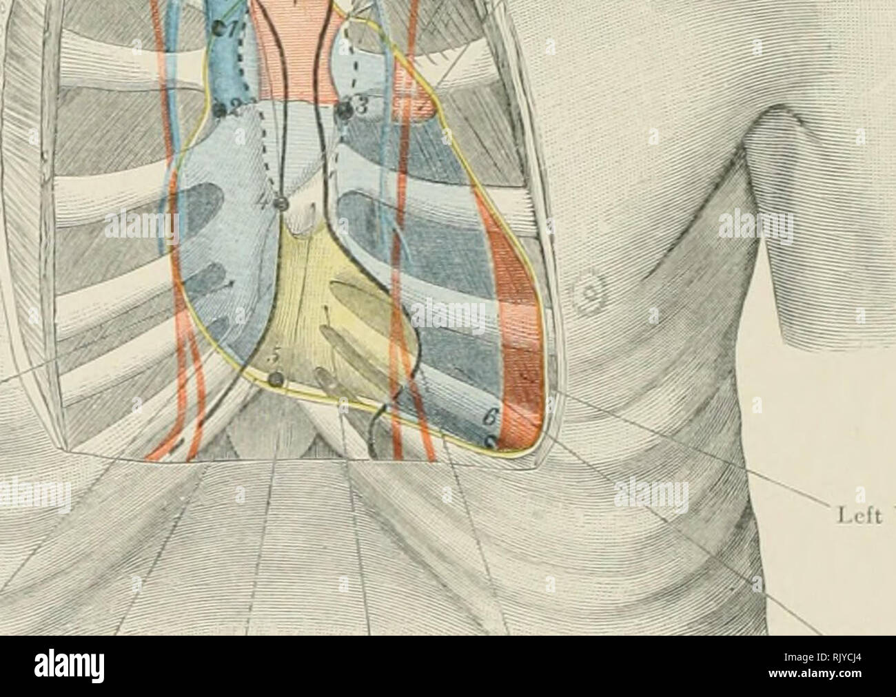 . Atlas of applied (topographical) human anatomy for students and practitioners. Anatomy. Left Innominate Vein Voiia Cava Superior Internal M.mimary V- . Right Pleura Arch of Aorta â Pulmonary Artery 1^ I-oft Auricle Atrium of Right Auricle .;: ;;^. Right Ventricle rcricardium Thymus Pericardium Left Pleura Ventricle Riyht Ventricle Fig. 118. Anterior Thoracic Wall and Heai-t in the New-Born. Nat. Size. Kebman Limited, London. Bebinan Company, New York.. Please note that these images are extracted from scanned page images that may have been digitally enhanced for readability - coloration and a Stock Photo