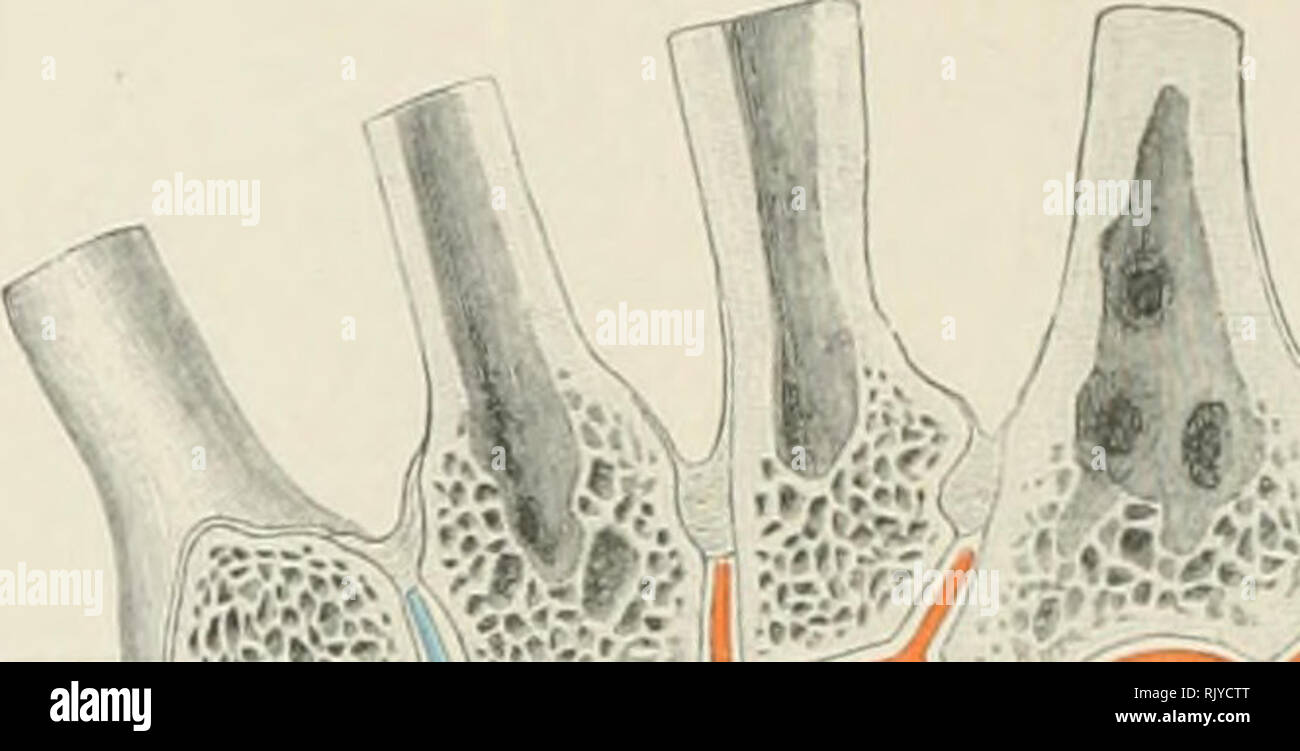 Human Bone Triangular Like Ict triangular hi-res stock photography and images - Alamy