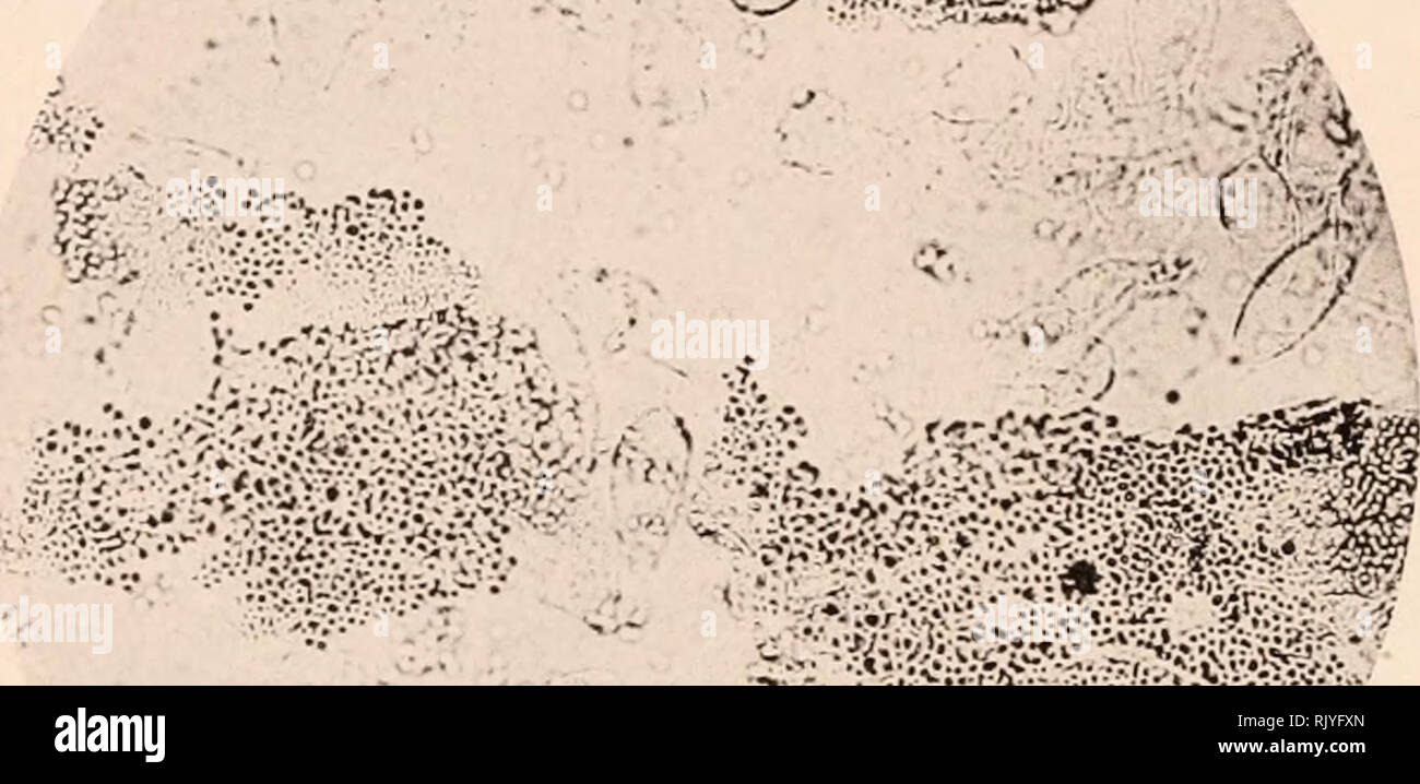 Decortication High Resolution Stock Photography And Images Alamy