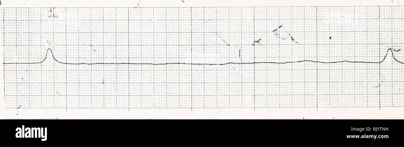 . Asiatic herpetological research. Reptiles -- Asia Periodicals; Amphibians -- Asia Periodicals. B pvi -if- .-{' . Pr-pi ,-P '&lt; *r m L ;&quot; 1 ^ 33 R A A D. FIG. 1. The electrocardiogram of the Chinese Alligator (Alligator sinensis ) under conditions of different temperatures as determined in 1988. A. April 8, 14° C. B. June 20. 21° C. C. Oct. 3, 16° C. D. Dec. 9, 4°C.. Please note that these images are extracted from scanned page images that may have been digitally enhanced for readability - coloration and appearance of these illustrations may not perfectly resemble the original work.. A Stock Photo