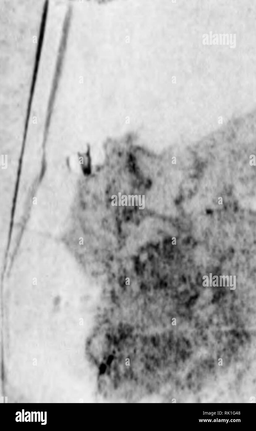 Loh Black And White Stock Photos Images Alamy