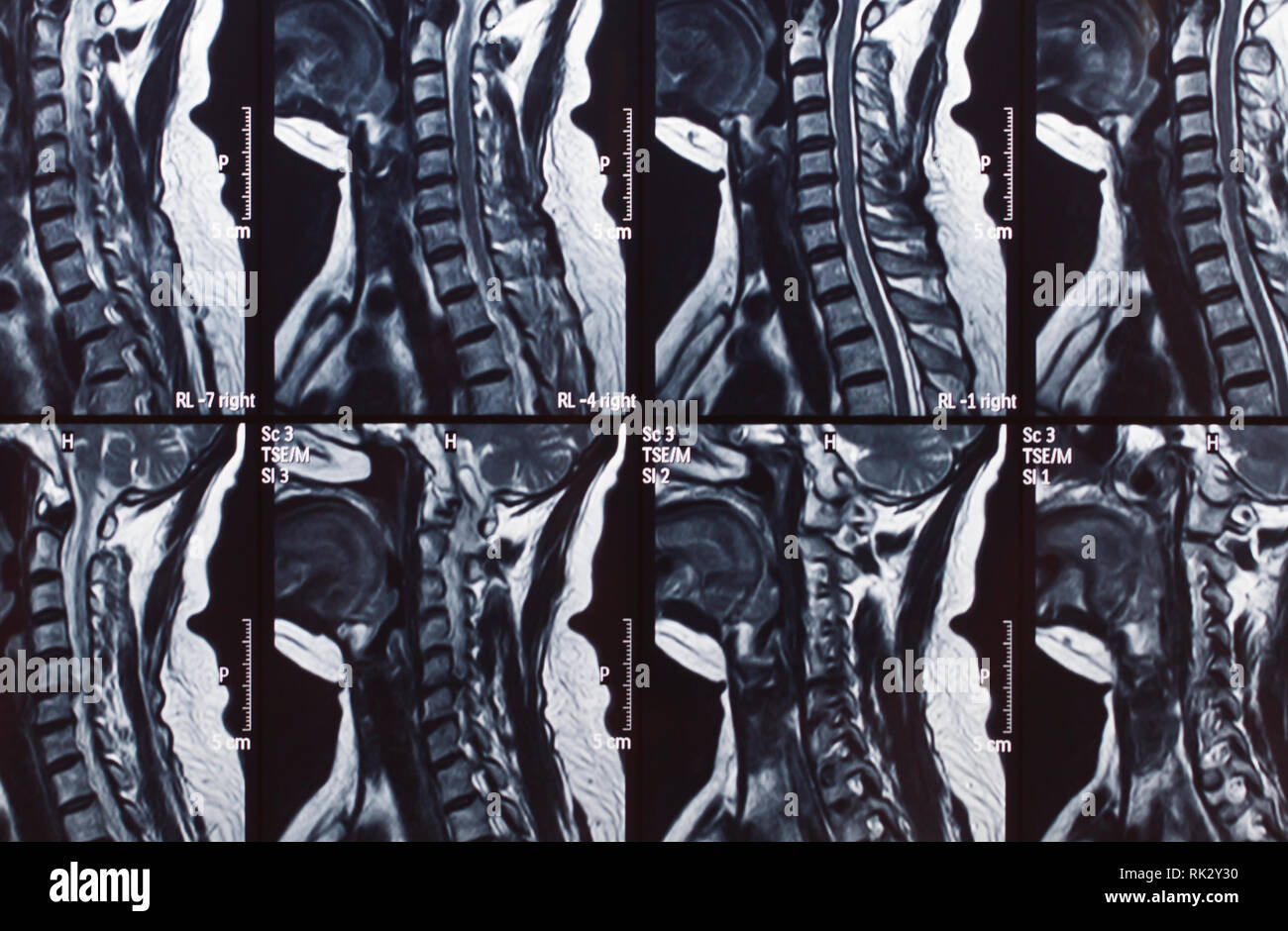 Human spine shadow hires stock photography and images Alamy