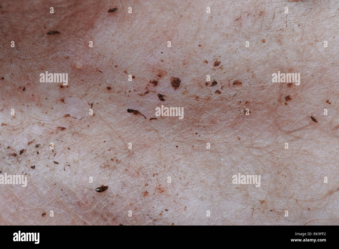 Pink skin on dog belly damage after flee bite Stock Photo Alamy