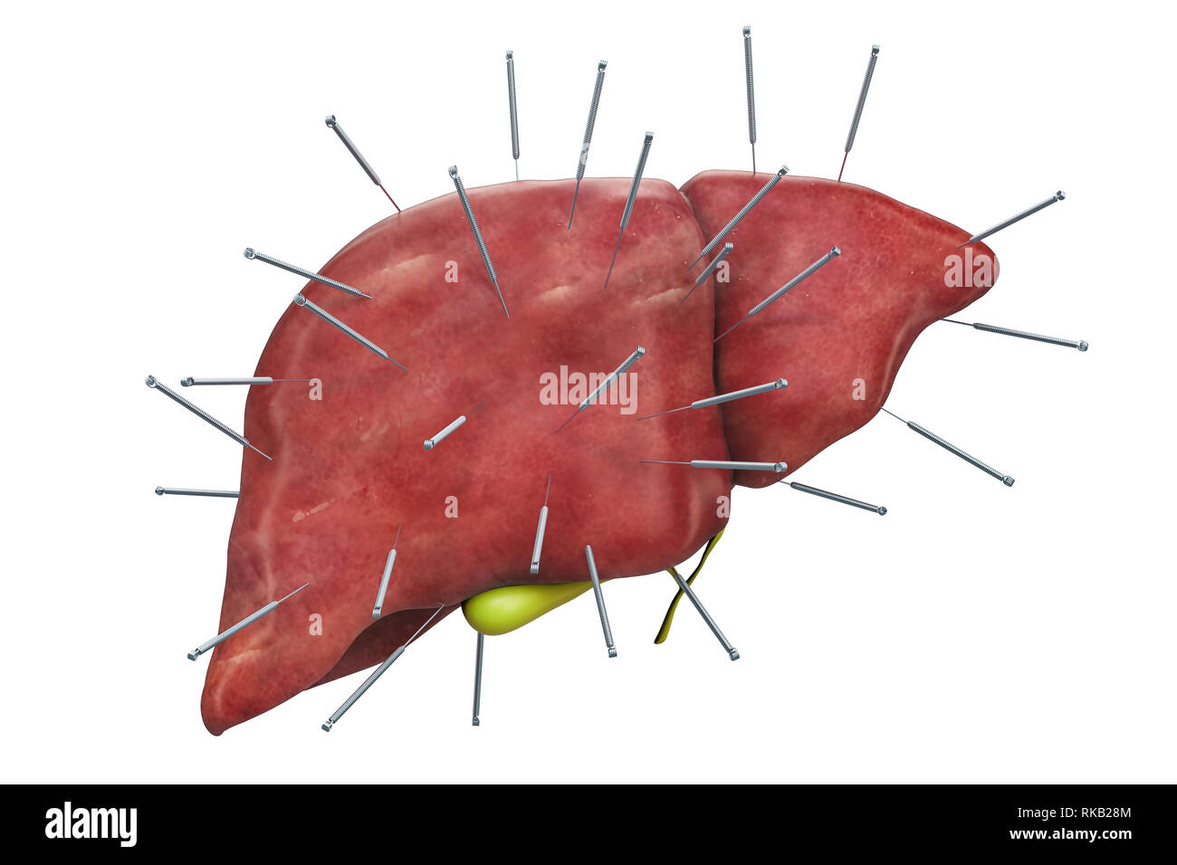 Human liver with acupuncture needles. Acupuncture treatment of liver concept, 3D rendering isolated on white background Stock Photo