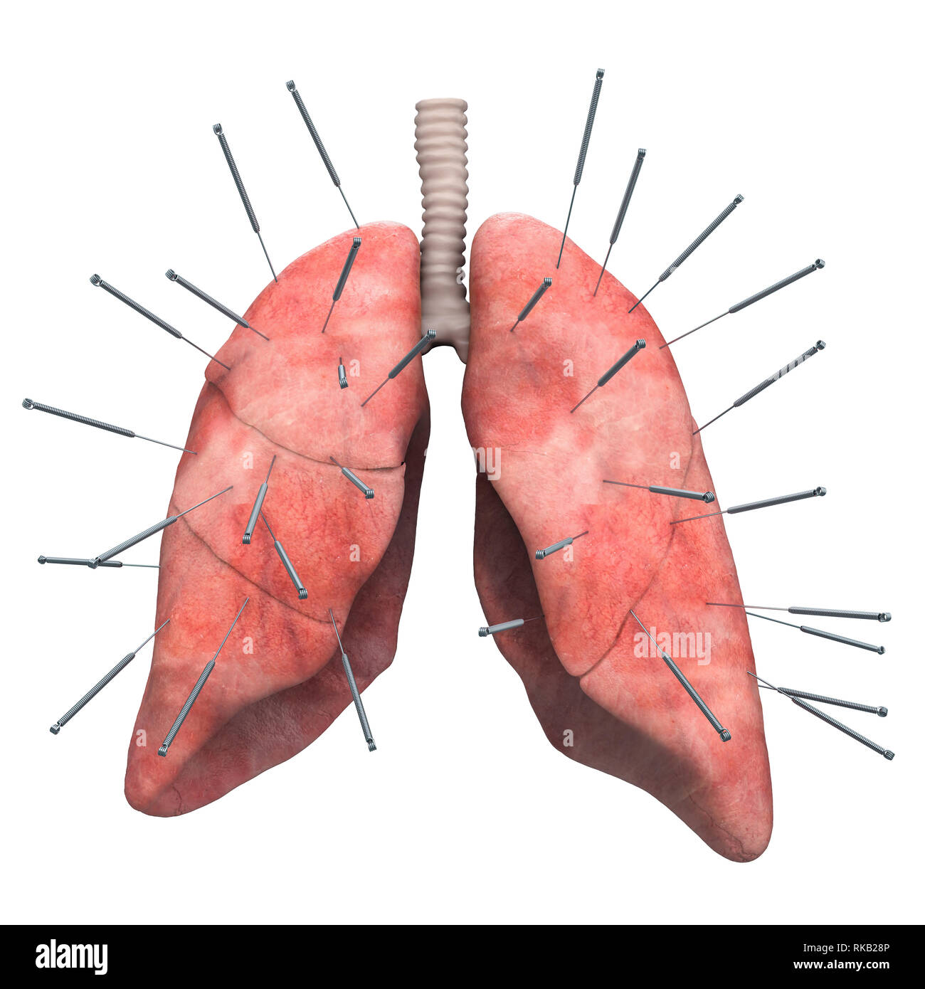 Human lungs with acupuncture needles. Acupuncture treatment of lungs