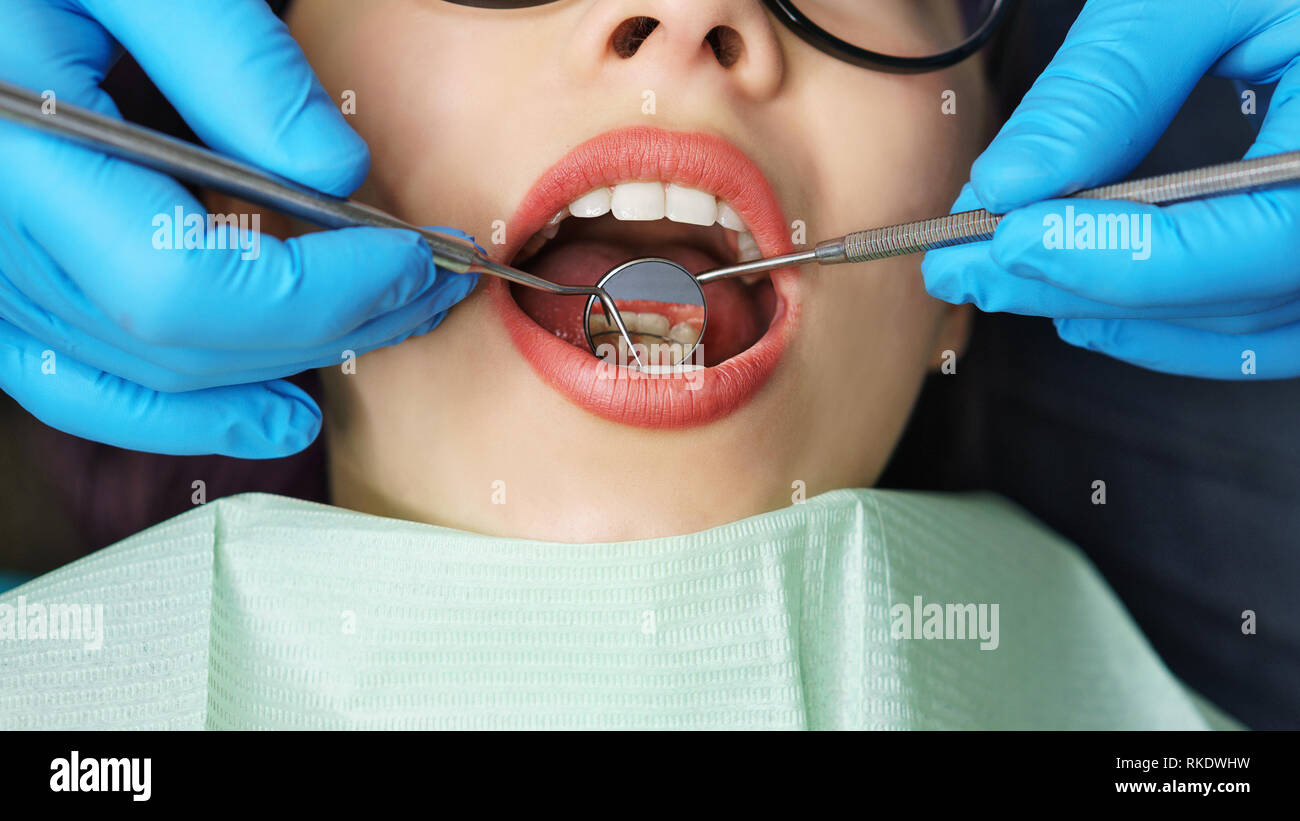 Routine examination at dentist. Young girl with open mouth. White teeth