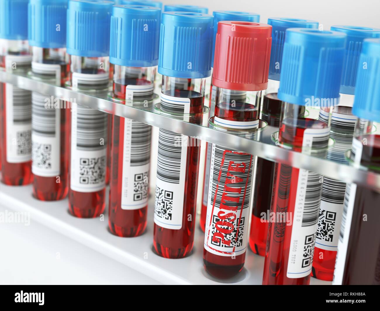 Blood sample positive and many others blood test tubes in a rack. 3d