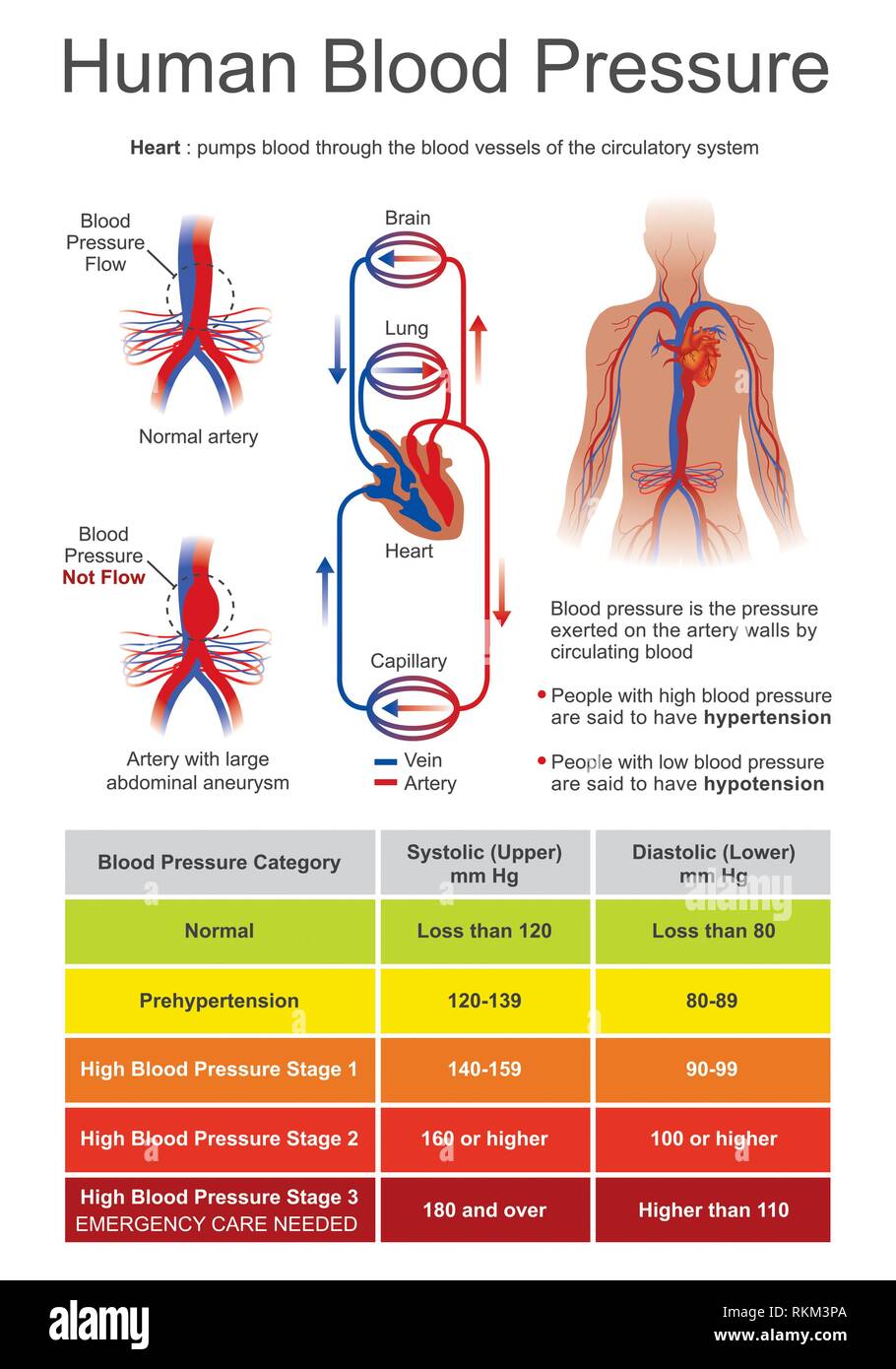 Blood pressure (BP) is the pressure of circulating blood on the walls