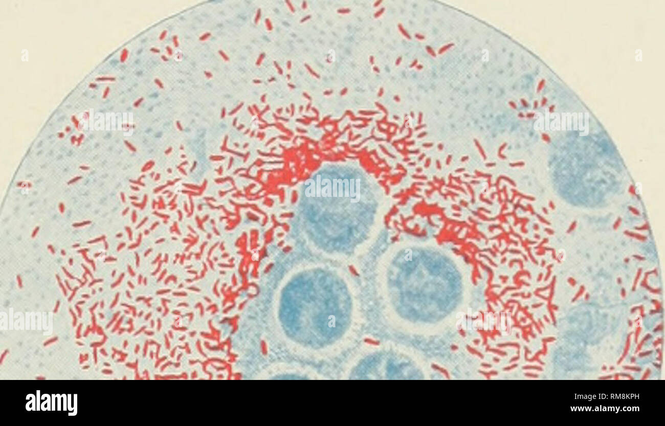 Leprosy bacillus hires stock photography and images Alamy