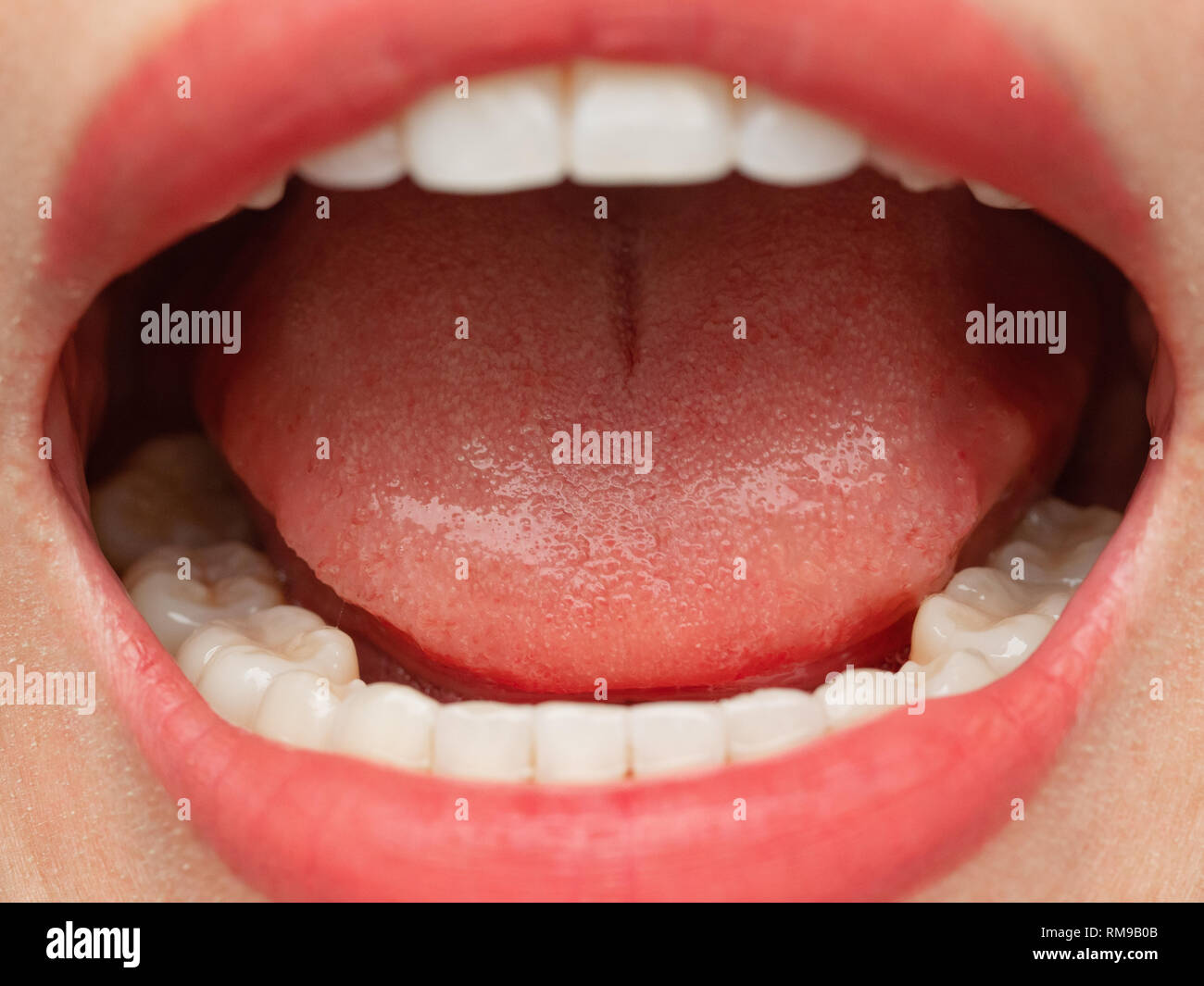 Closeup Shot Of Asian Chinese Thai Woman Female Makeup Face Woman With Red Lips Lipstick And Healthy Dental White Great Perfect Teeth Smiling Denta Stock Photo Alamy