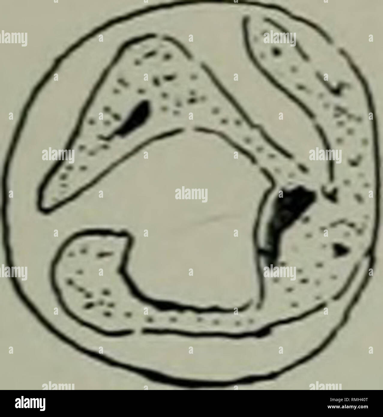 . Annals of tropical medicine and parasitology. Parasites. Annals Irop.  Med. cf rarasit Flate Y .;. Fix. 18 KiK. 1!» FiK. 20 Fig. 21 A SUDANESE  MADUROMVCOSIS. Please note that these images are extracted from scanned  page images that may have been