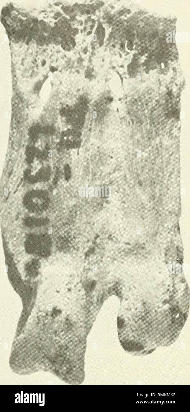 Medial calcaneal hi-res stock photography and images - Alamy