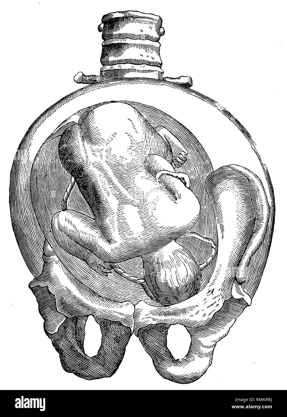 Fetus in the uterus. Occipital location,   1900 Stock Photo