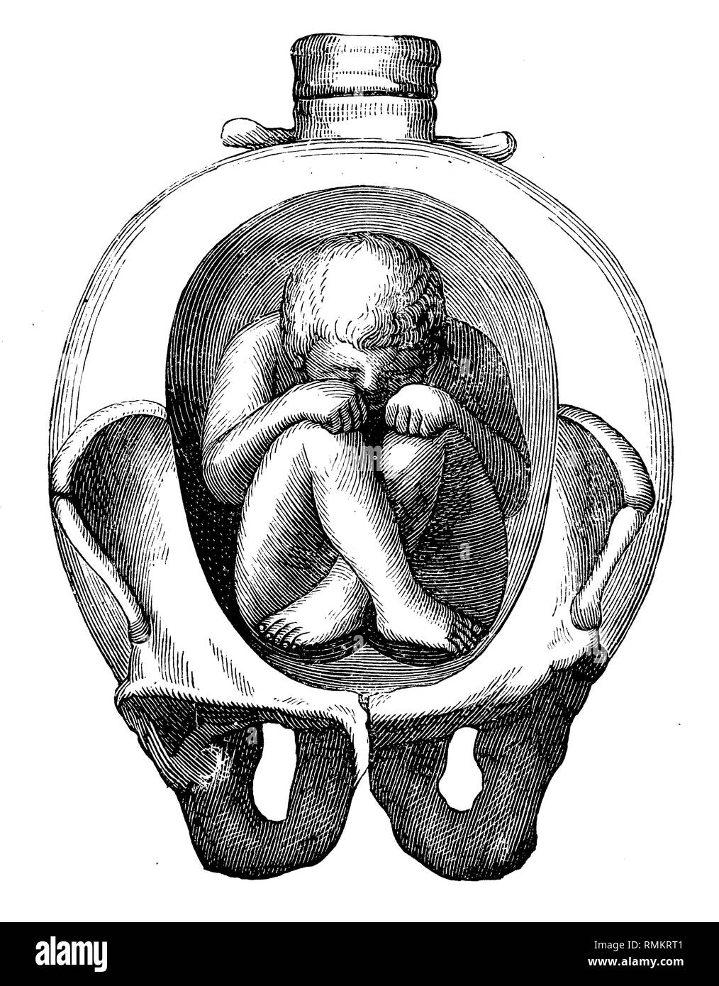 Fetus in the uterus.,   1900 Stock Photo