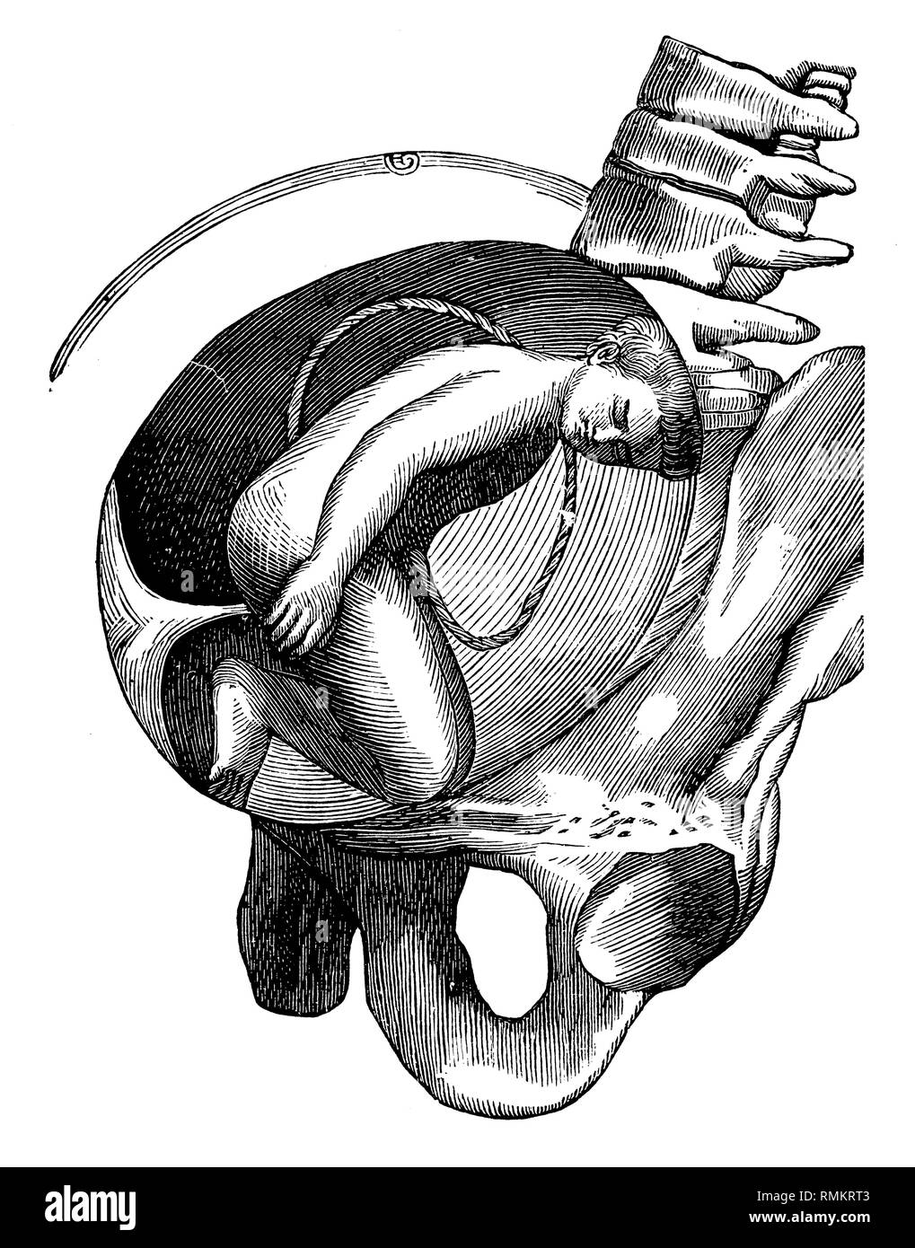 Fetus in the uterus. Knee layer, side view,   1900 Stock Photo