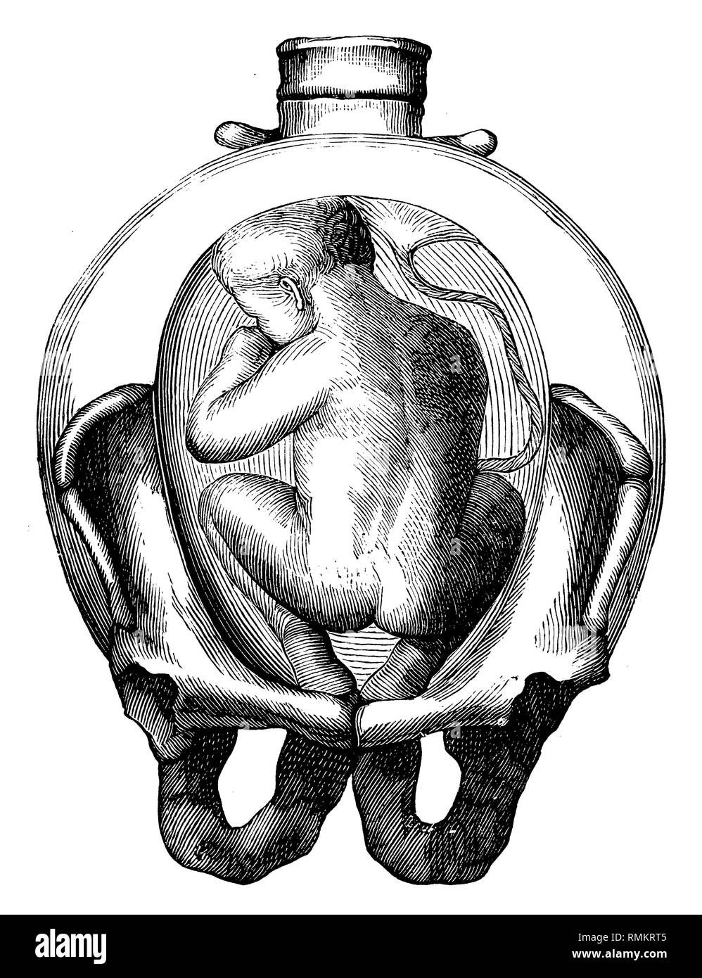 Fetus in the uterus,   1900 Stock Photo