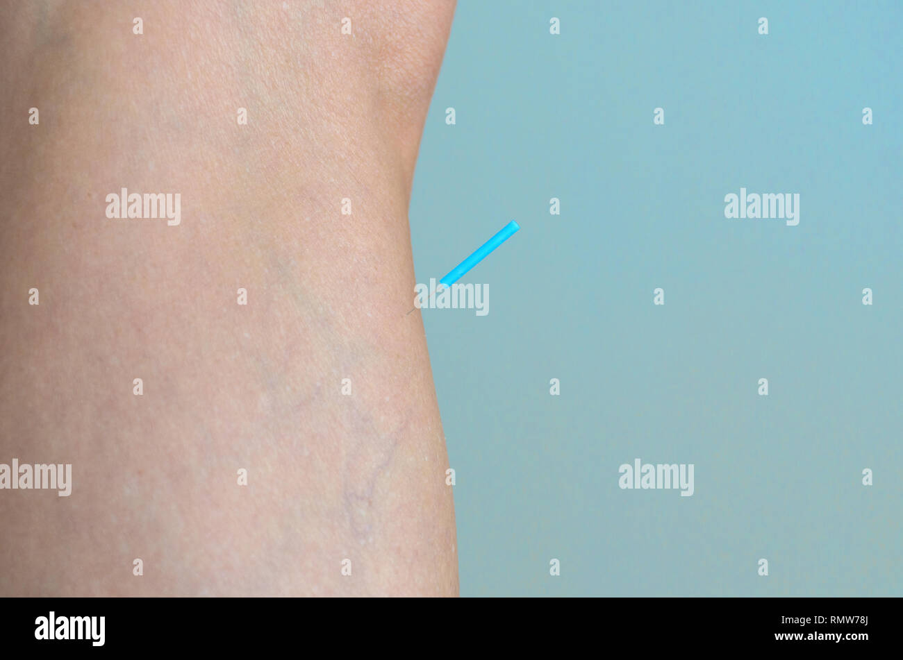 Skin close up vein hires stock photography and images Alamy