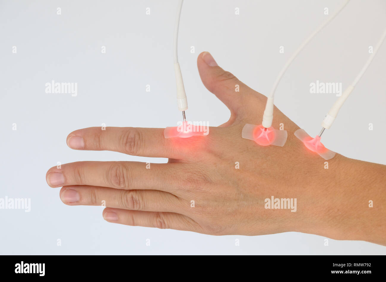 Woman having EMS or electrical Muscle Stimulation on her hand with attached therapeutical electrodes isolated over white Stock Photo