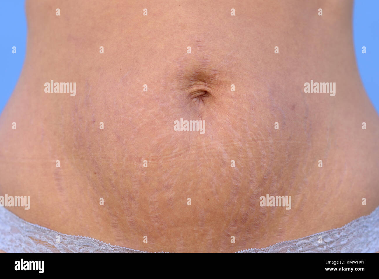 Lower abdomen hi-res stock photography and images image