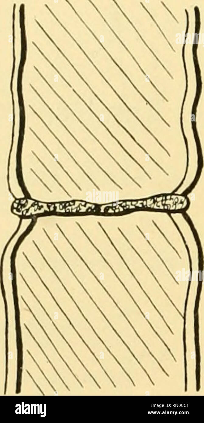 Annales De La Station Limnologique De Besse Natural History Natural History Souvent Plisse Et Pourvu D Une Rangee De Tubercules Chromoleucites Parietaux Nombreux Disposes En Bande Lettes Longitudinales Pourvues D Une Serie De
