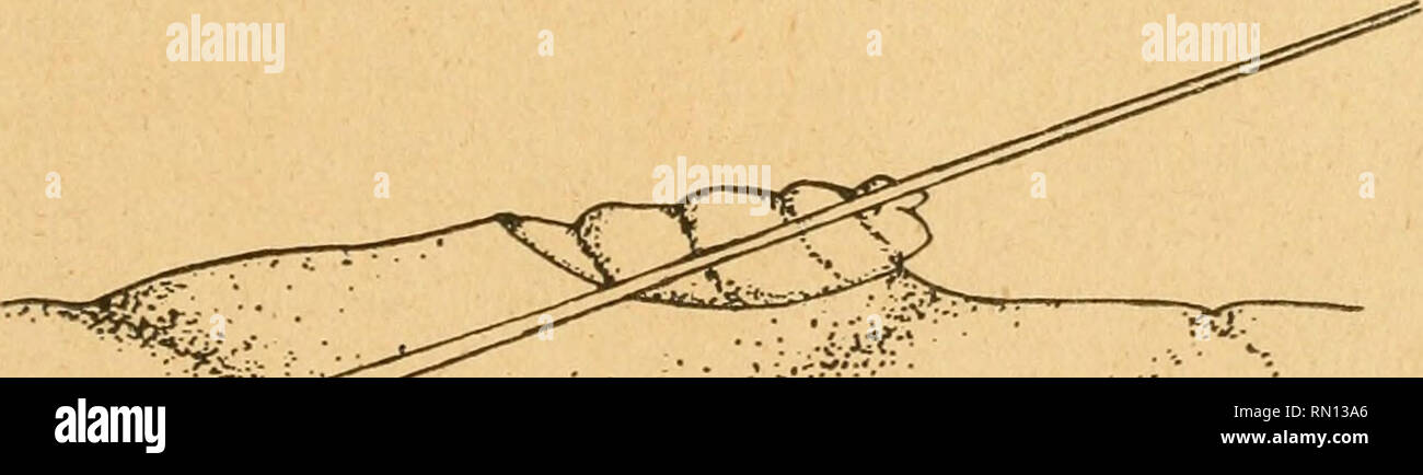 . Annales de la Société entomologique de Belgique. Insects; Entomology. 195 La femelle gravide renferme un grand nombre d'œufs; nous en avons vu plus de cinquante paraissant bien développés dans les ovaires d'un seul individu. Eclosion de l'œuf et pénétration de la jeune larve dans la peau de son hôte. -? Au moment de l'éclosion, l'un des pôles de l'œuf se fend irrégulièrement et il-en sort une larve minuscule, mince, très mobile. L'un de nous l'ayant pl;icée immédiatement sur la peau de son bras, nous observons ses mouvements à la loupe. Sans se déplacer, la jeune larve cherche immédiatement  Stock Photo